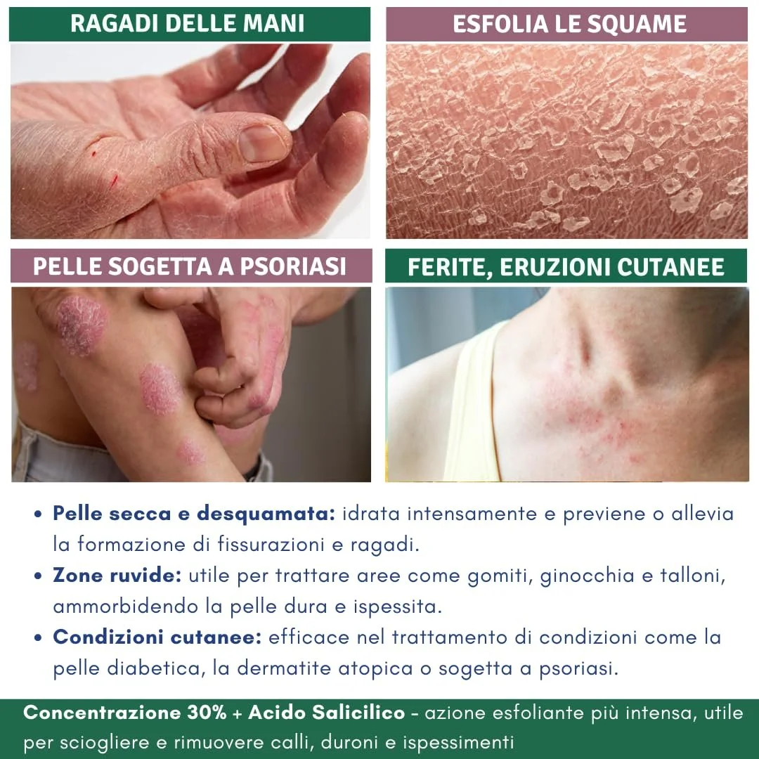 Крем для ног Eladerm с мочевиной 30% 100 мл, фото №5 Крем для ног Eladerm с мочевиной 30% 100 мл, фото №5