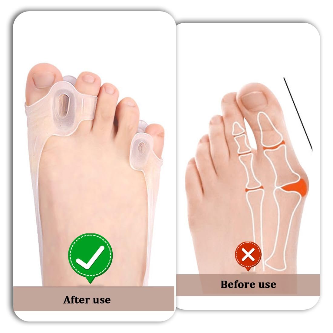 Шина для великого пальця стопи Силіконовий роздільник пальців Ортопедичний, фото №3