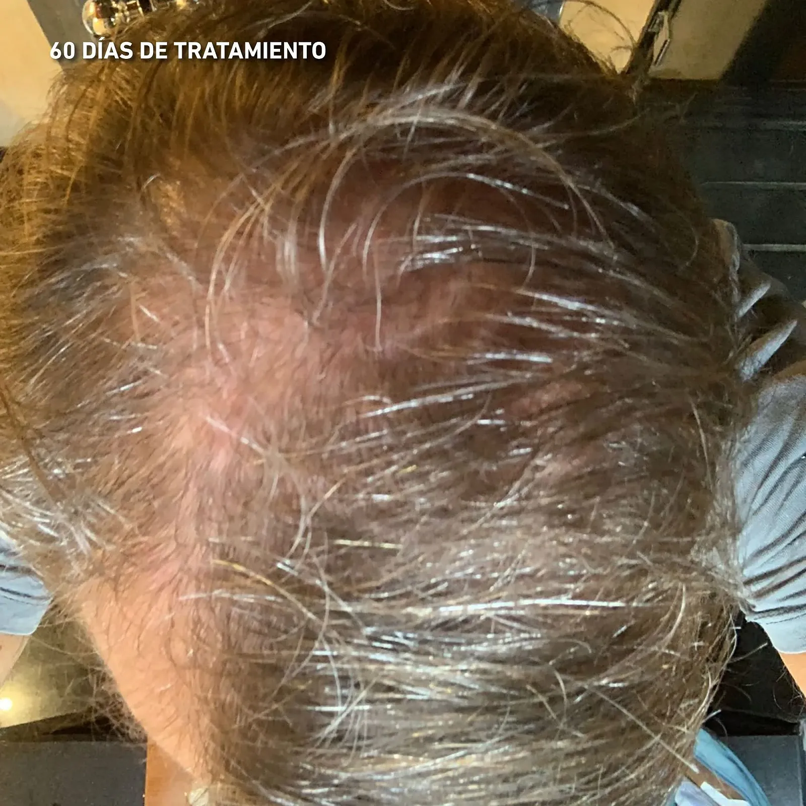 Лосьйон HEY JOE! Power Чоловічий лосьйон проти випадіння волосся 150 мл, фото №3 Лосьйон HEY JOE! Power Чоловічий лосьйон проти випадіння волосся 150 мл, фото №3