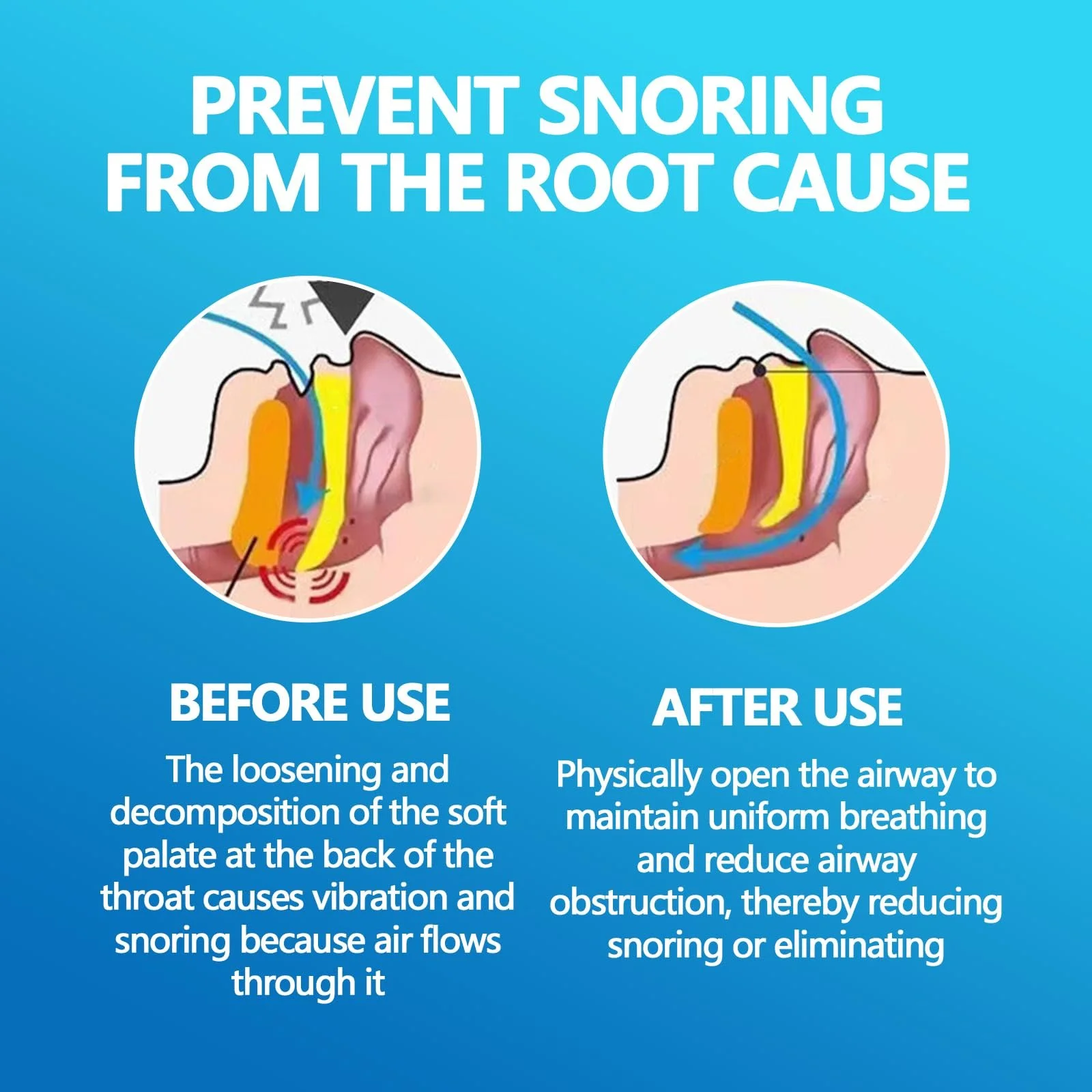 Пластыри от храпа Белые Wavy (250 шт. в упаковке), фото №2 Пластыри от храпа Белые Wavy (250 шт. в упаковке), фото №2