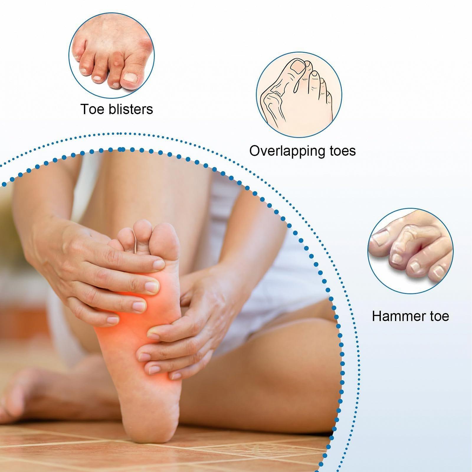 Тканинний набір з роздільником, еластичні аксесуари для ніг для комфорту та зменшення тертя, підходить для чоловіків та жінок, фото №5 Тканинний набір з роздільником, еластичні аксесуари для ніг для комфорту та зменшення тертя, підходить для чоловіків та жінок, фото №5