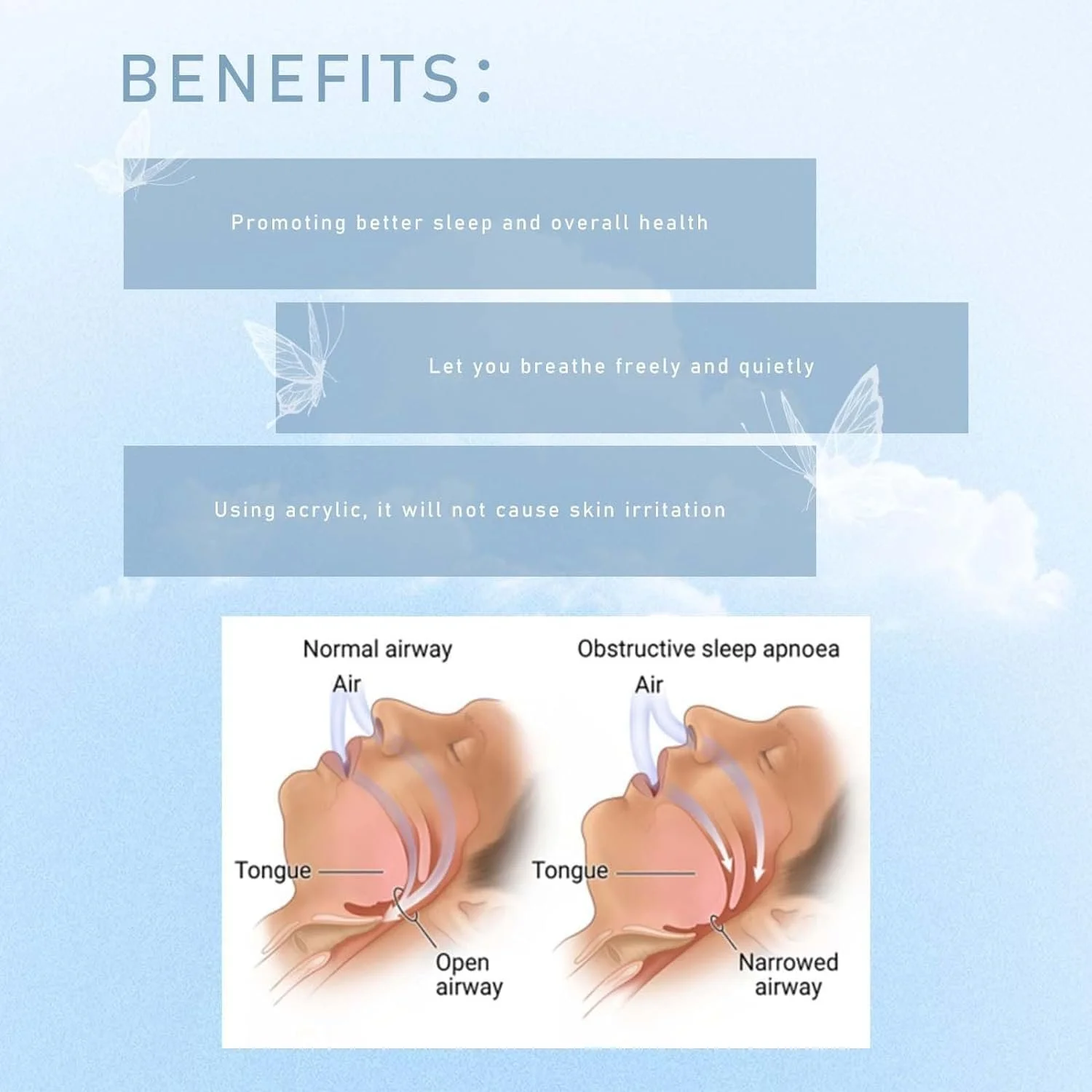 Клипса от храпа Zriol для носа, клипса для носового дыхания, магнитная, фото №3 Клипса от храпа Zriol для носа, клипса для носового дыхания, магнитная, фото №3