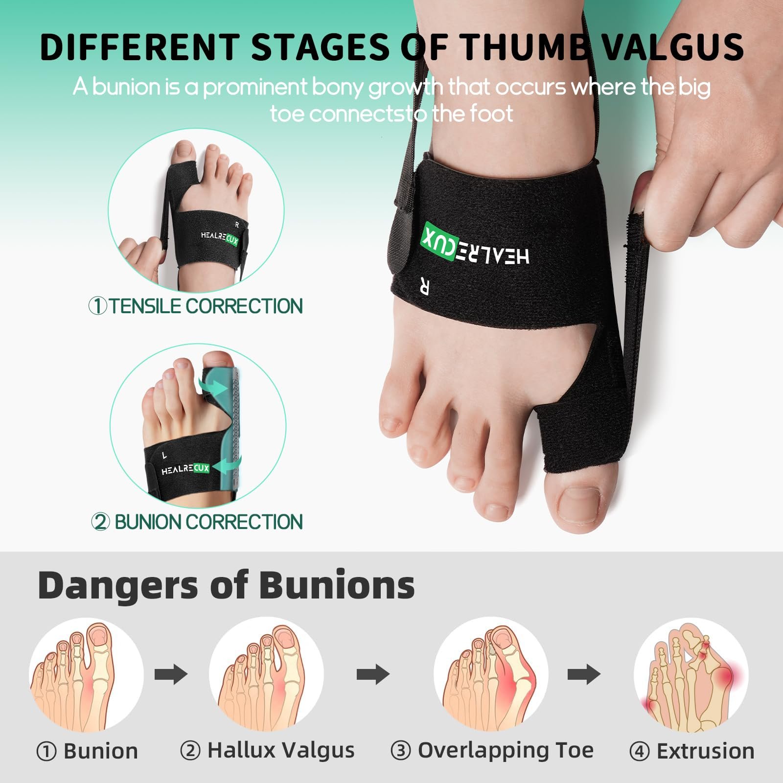 Коректор великого пальця стопи для чоловіків і жінок, Шина для корекції вальгусної деформації, фото №4