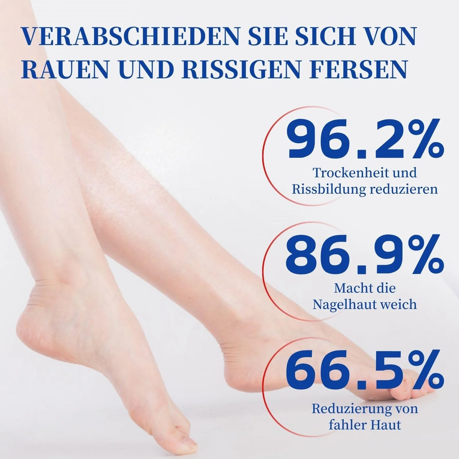 Крем для ног Urea 60% интенсивный 200 г, фото №3