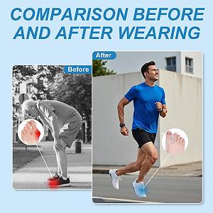 Роздільник для пальців ніг Ecarteur 6 шт., Коректор вальгусної деформації великого пальця стопи - Фото 1