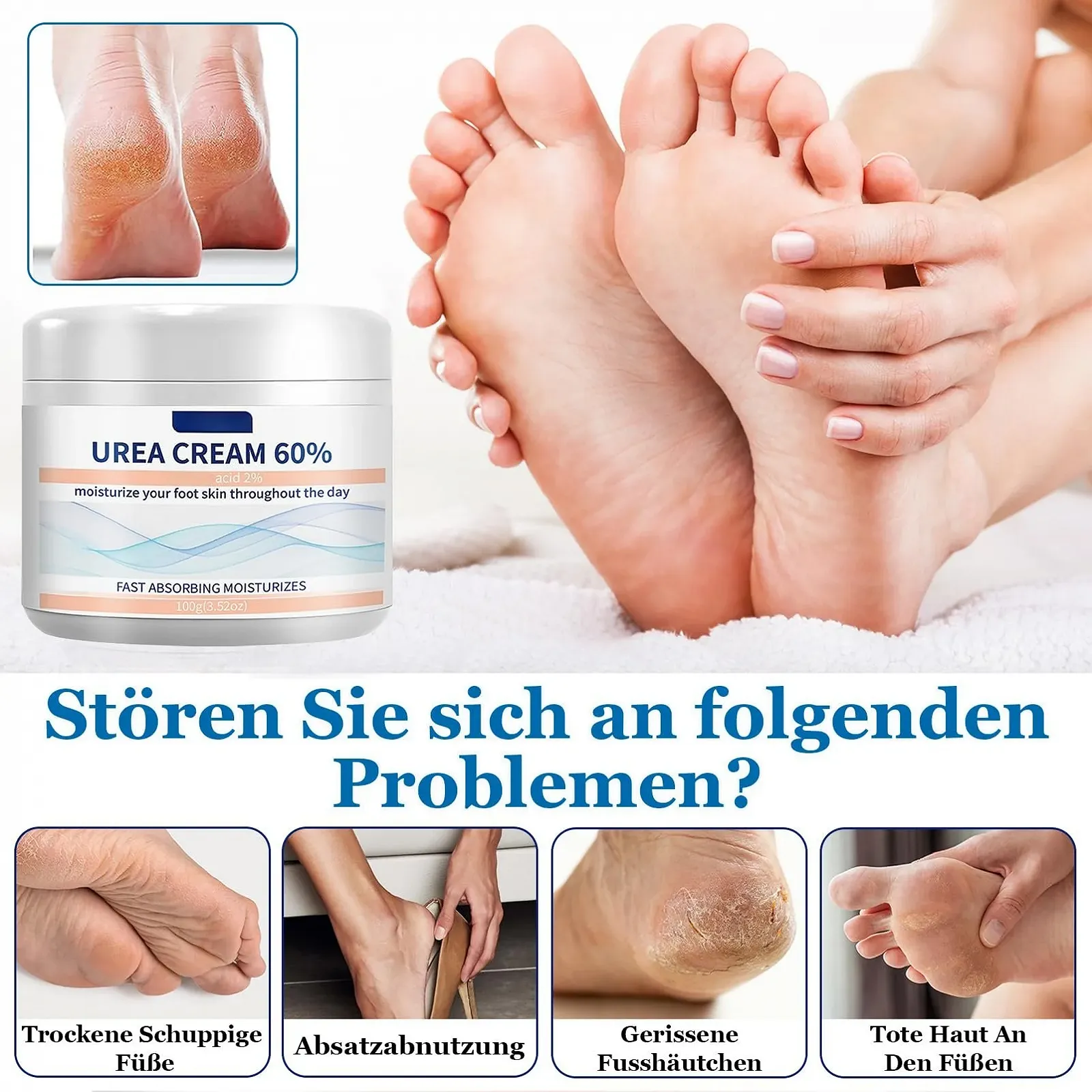 Крем для ног Urea Cream 60% мочевины и 2% кислоты против мозолей и сухости, 100 г, фото №2