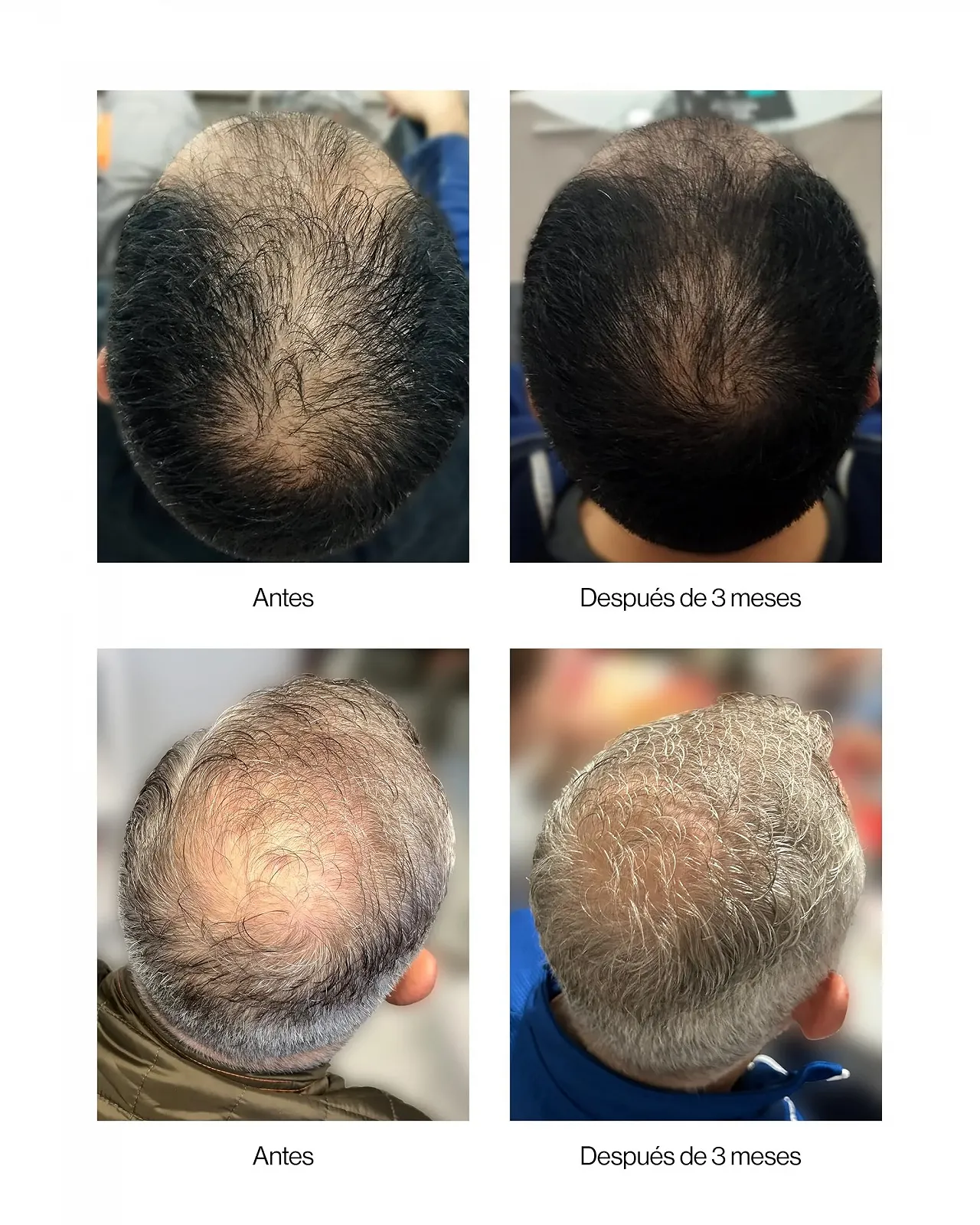 Лосьйон Thader Pharma Концентрований проти випадіння волосся з мультипептидами Neoxil Peptides 50 мл, фото №8 Лосьйон Thader Pharma Концентрований проти випадіння волосся з мультипептидами Neoxil Peptides 50 мл, фото №8