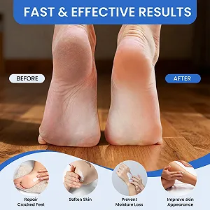 Крем для ног и рук с мочевиной 40% Urea Cream с гиалуроновой кислотой и маслом ши 150 г synthetic.ua - Фото 1