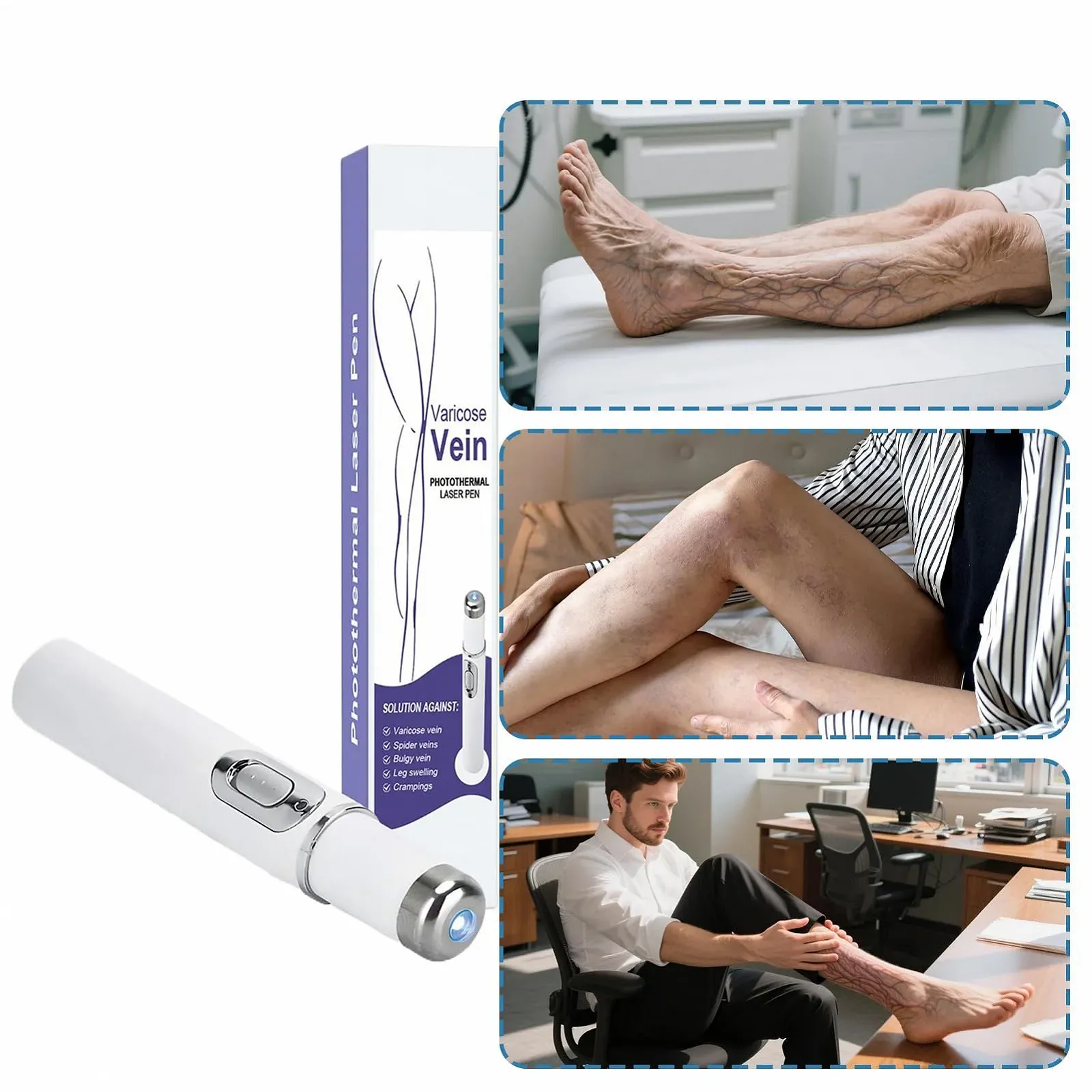 Прилад для видалення судинних зірочок портативний бездротовий на батарейках, фото №8