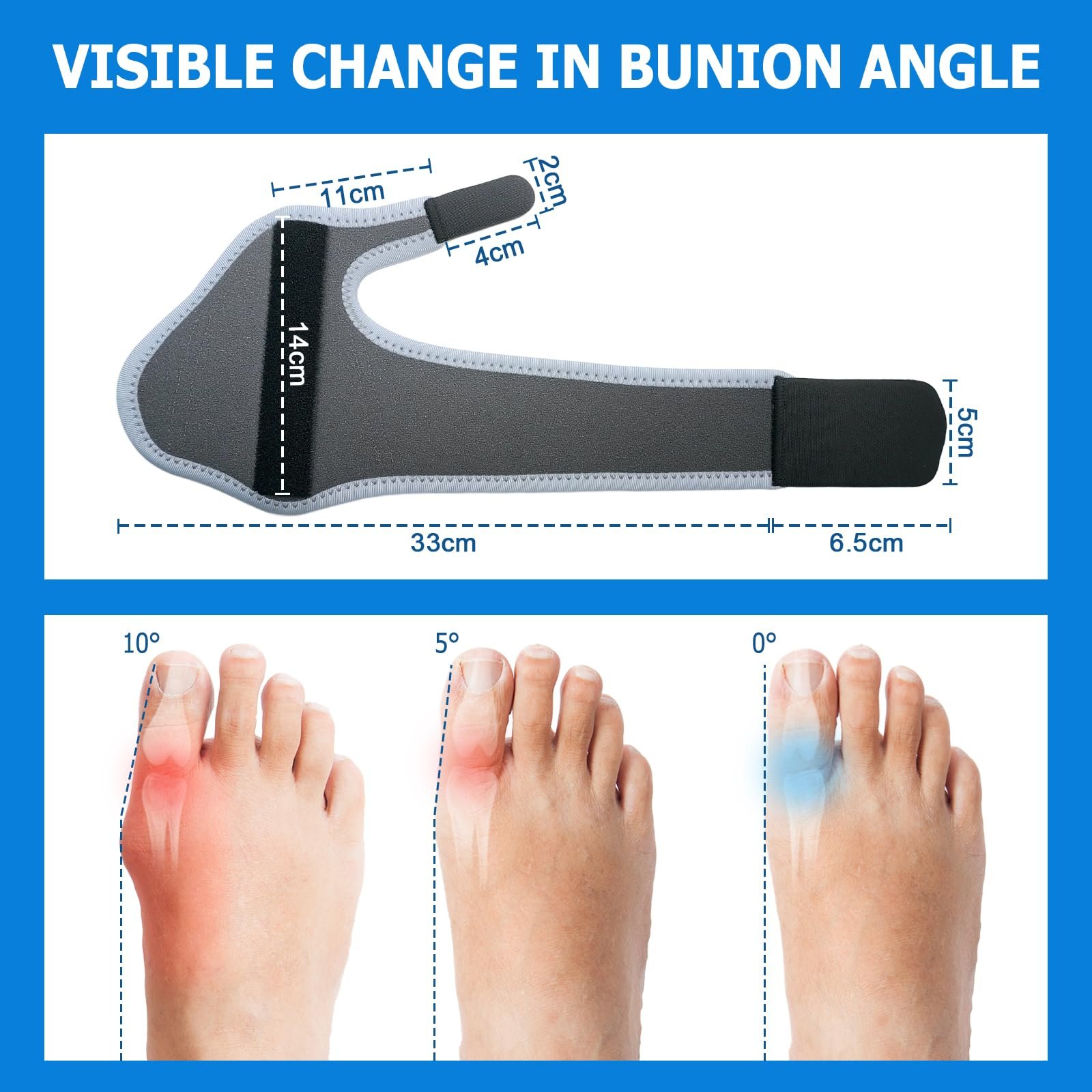 Шина для коррекции Hallux Valgus, корректор Hallux Valgus, корректоры молотковидных пальцев, фото №5 Шина для коррекции Hallux Valgus, корректор Hallux Valgus, корректоры молотковидных пальцев, фото №5