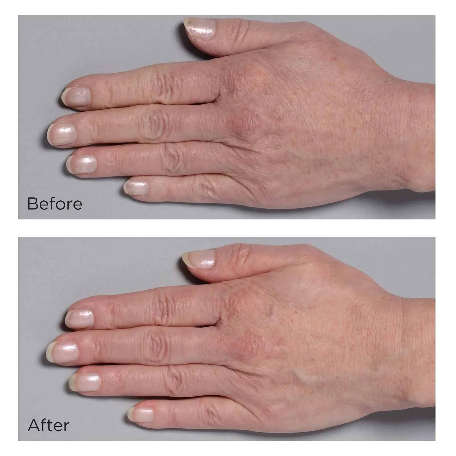 Крем Perricone MD Cold Plasma+ для рук 59 мл, фото №3