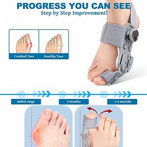 Шина для корекції Hallux Valgus Регульована шина з поворотним регулятором, силіконовий роздільник synthetic.ua - Фото 1