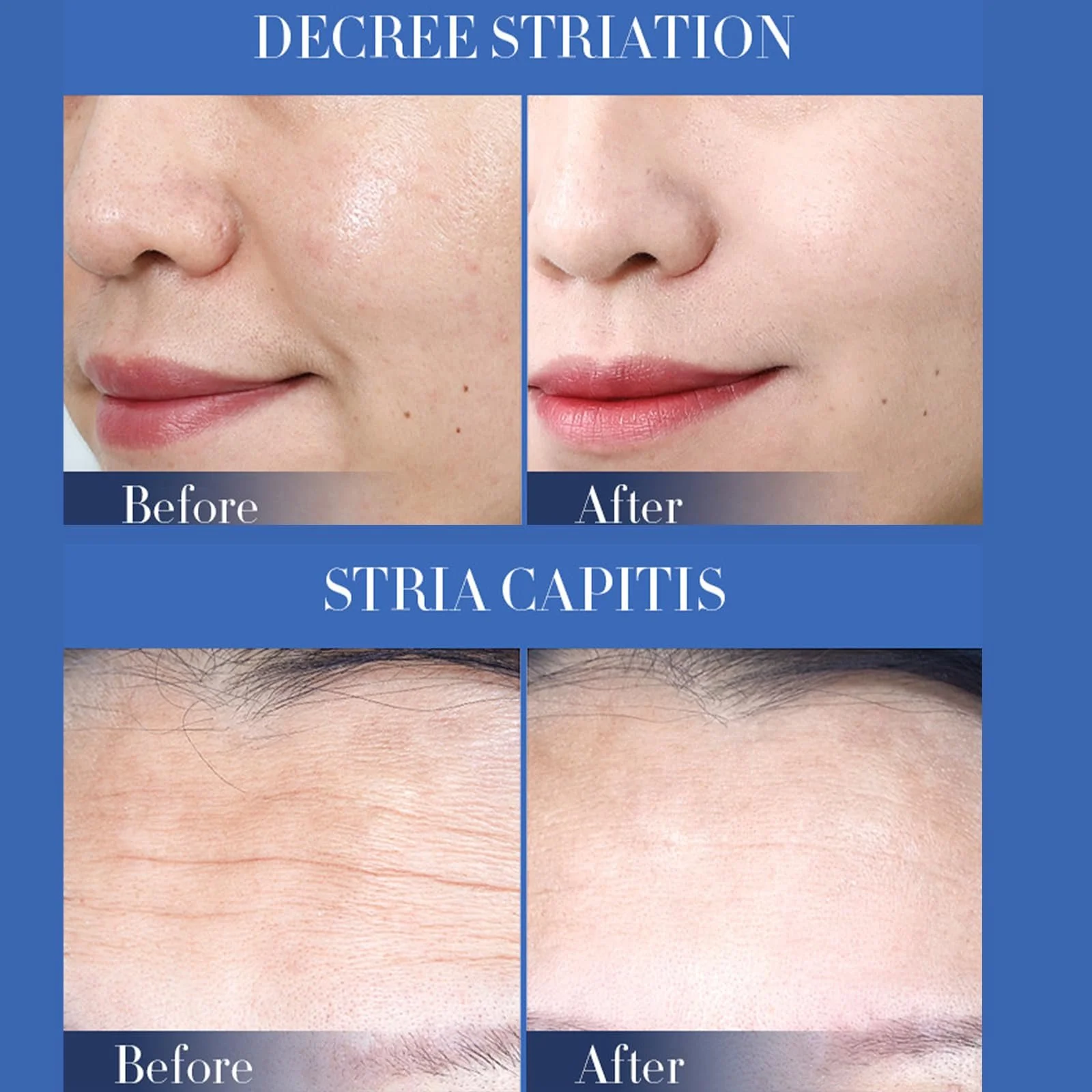 Маска для обличчя Зволожуюча Антивікова маска, 8 шт Тканинна маска преміум-класу, фото №4