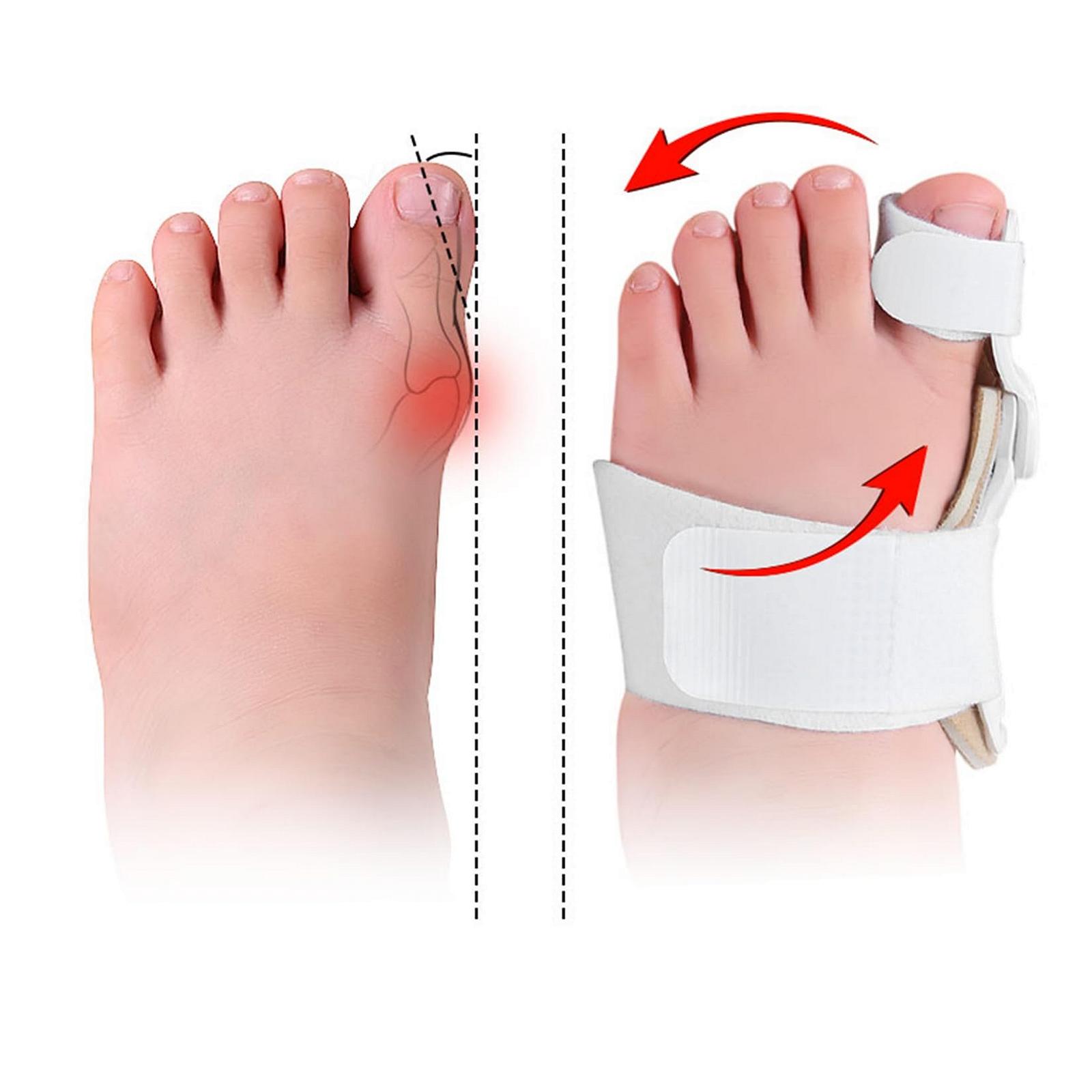 Дитячий коректор вальгусної деформації, шина, фото №5