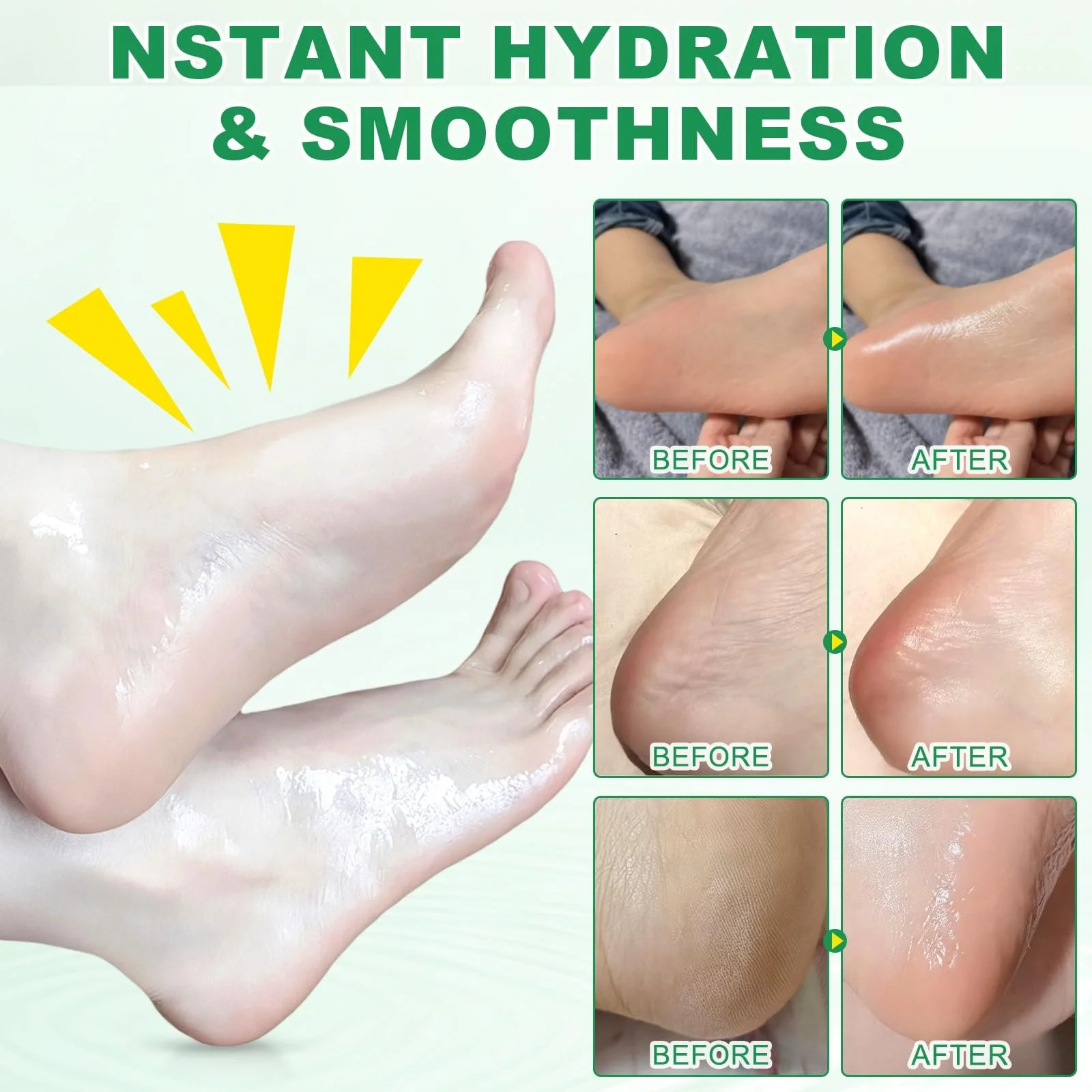 Крем для ног с мочевиной 60% и салициловой кислотой 2% для сухой и потрескавшейся кожи, против мозолей, упаковка из 2 шт., фото №8