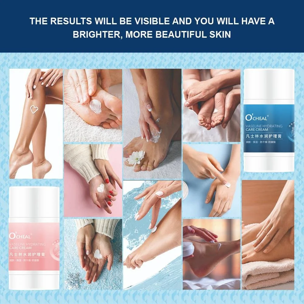 Крем для рук и ног O'CHEAL Anti-Drying Crack восстанавливающий для сухой кожи, фото №4