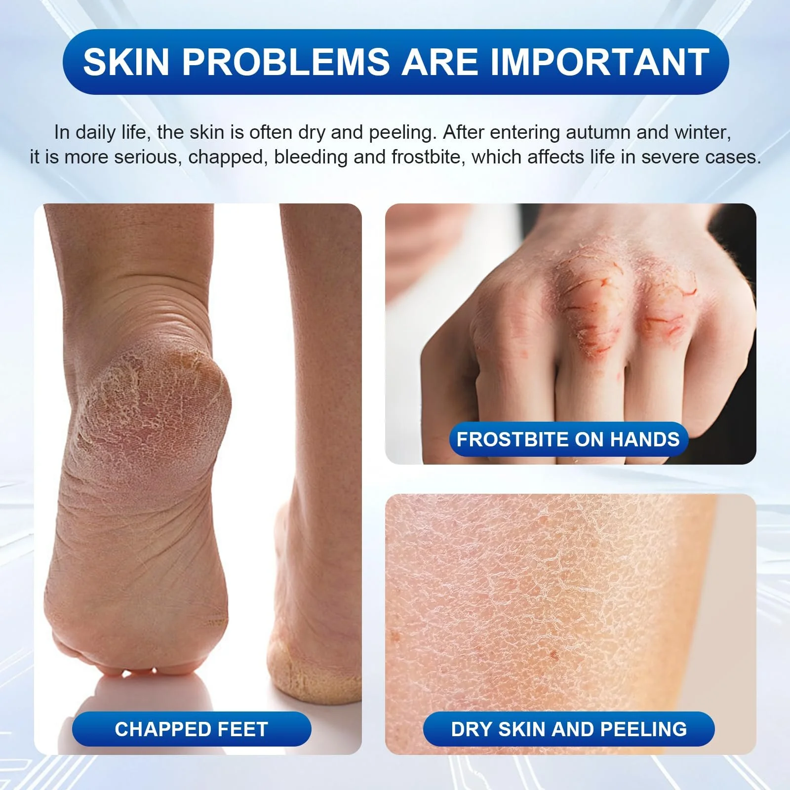 Лосьон-крем для ног Urea 40% против трещин и мозолей 100 мл, фото №3