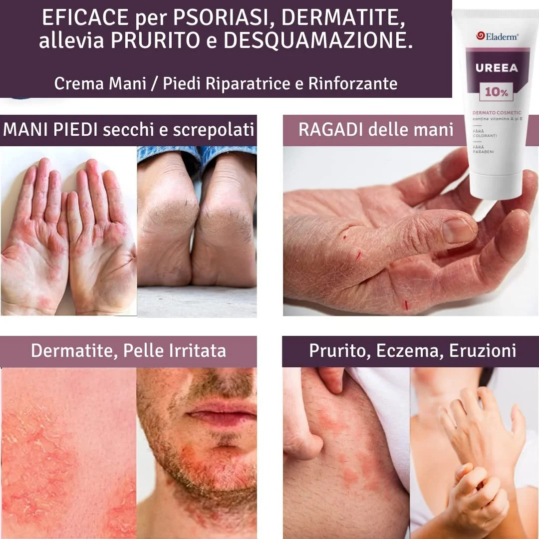 Крем для ног Urea Cream 10% 100 мл, фото №6 Крем для ног Urea Cream 10% 100 мл, фото №6