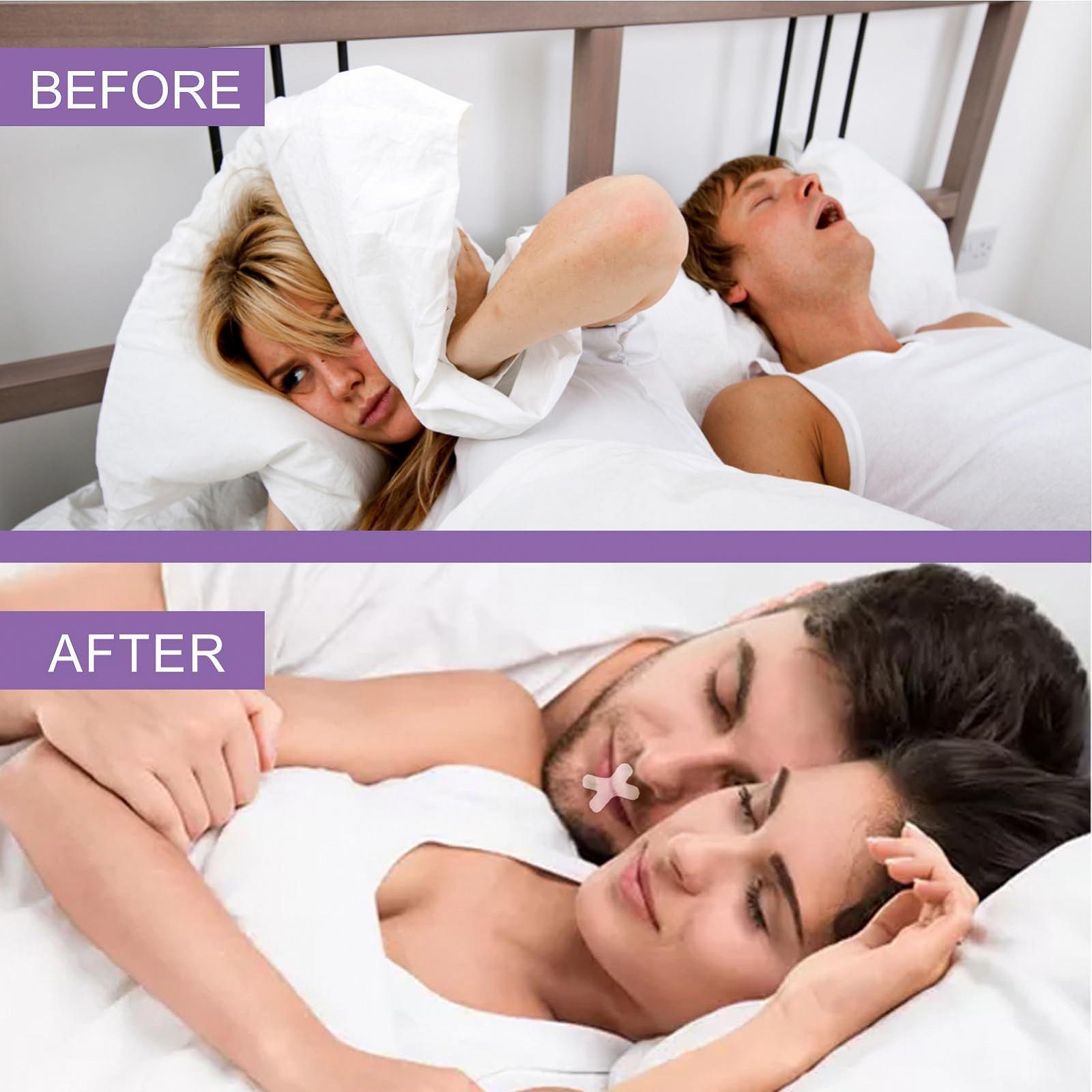 Смужка для рота для сну Bexdug, 120 шт, фото №9