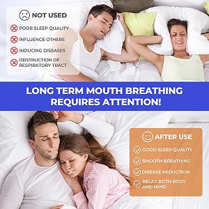 Смужки для рота еластичні Economical Pickstar для сну проти хропіння, 50 шт. synthetic.ua - Фото 1