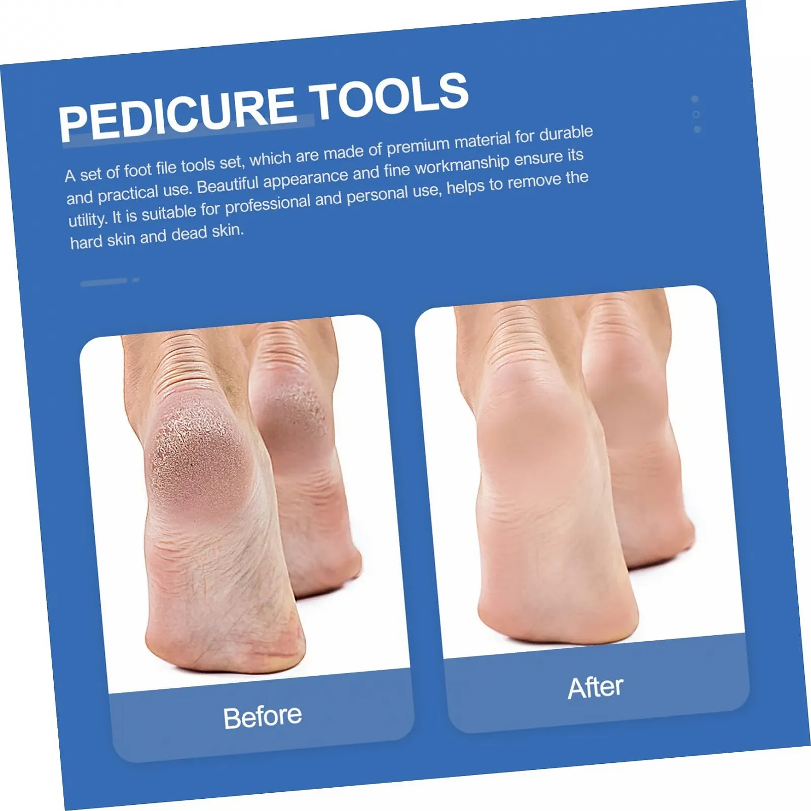 Набор для ухода за ногами Healvian 5 предметов из нержавеющей стали, инструменты для педикюра для эффективного удаления мозолей и вросшего ногтя, фото №8
