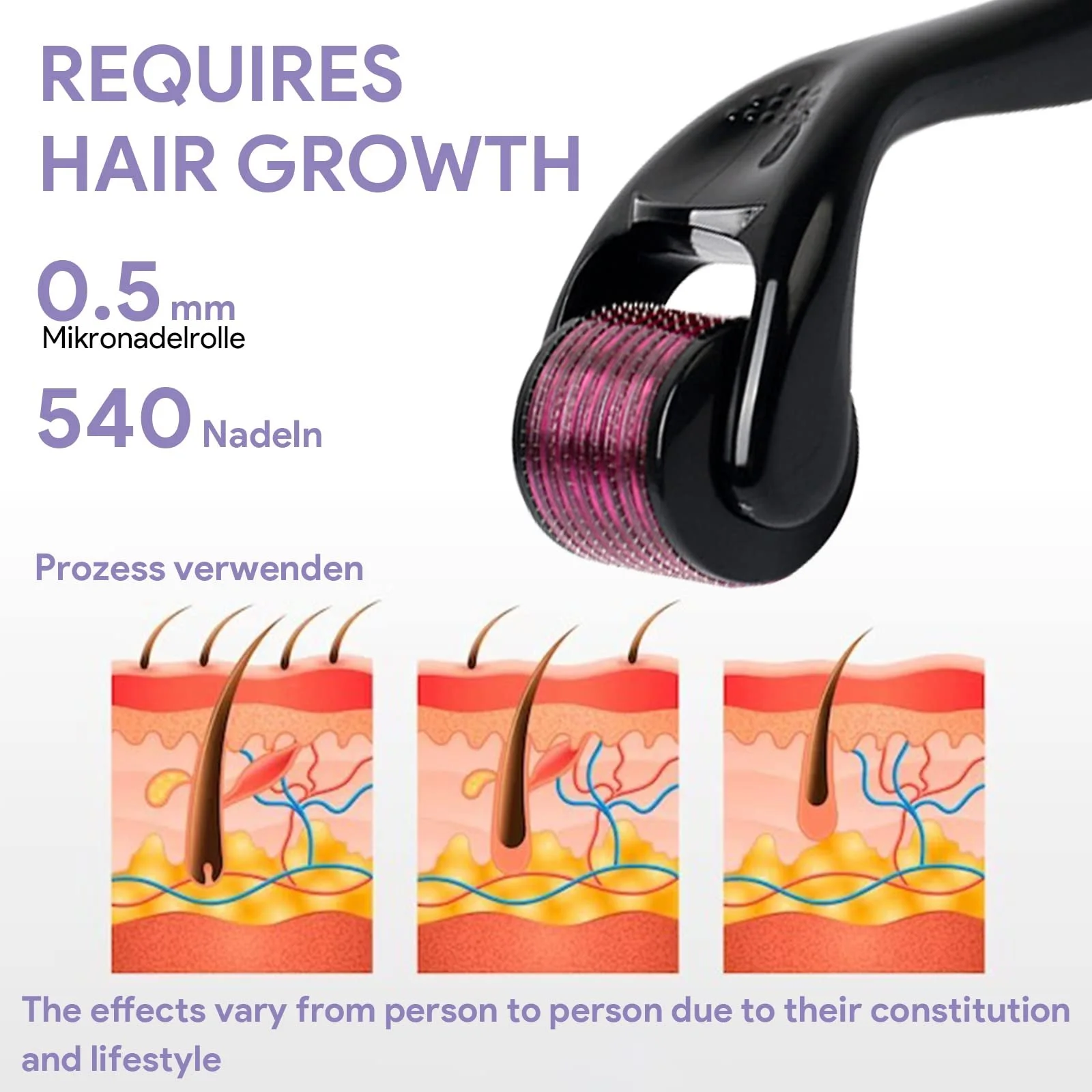 Набір з 2 Дерма ролерів для шкіри голови, фото №3