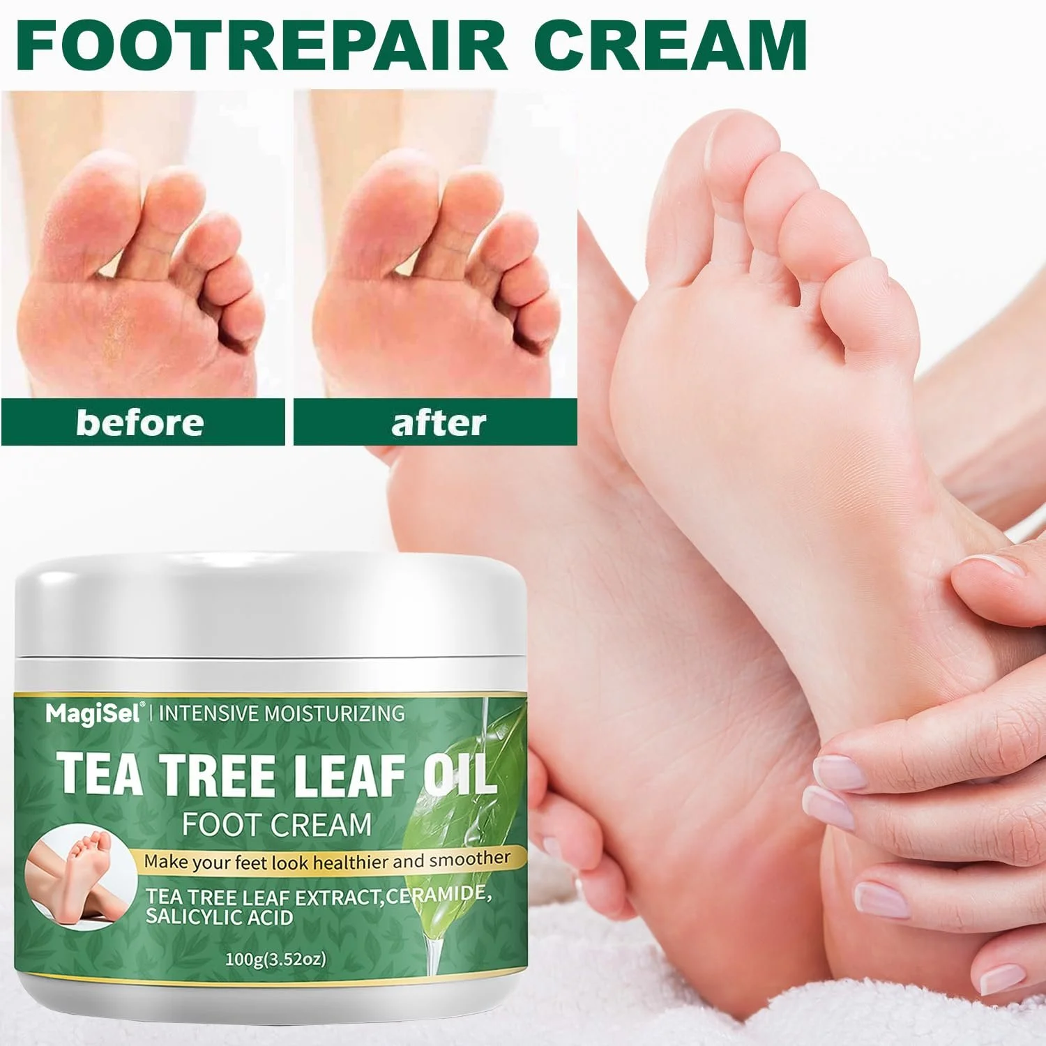 Крем для ног увлажняющий с чайным деревом против трещин и мозолей 100 г, фото №7