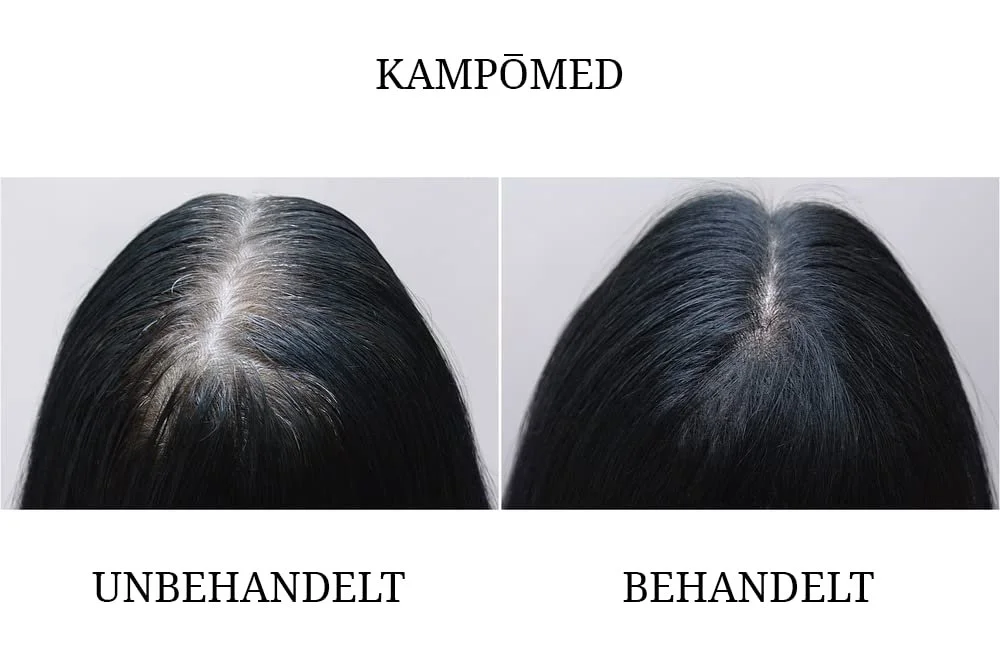 Спрей-сироватка Kampomed Recovery Booster для росту волосся для чоловіків і жінок, 100 мл, фото №2 Спрей-сироватка Kampomed Recovery Booster для росту волосся для чоловіків і жінок, 100 мл, фото №2