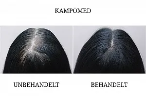 Спрей-сыворотка Kampomed Recovery Booster для роста волос для мужчин и женщин, 100 мл synthetic.ua - Фото 1