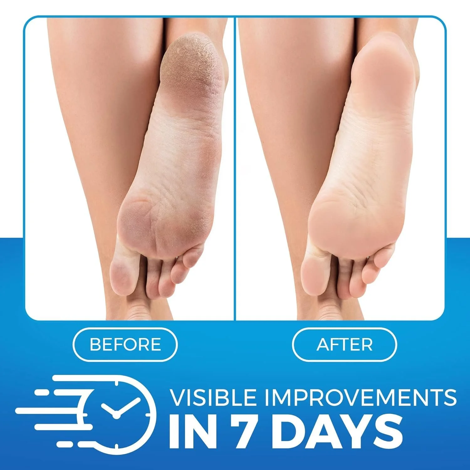 Бальзам для ніг Imperial Feet Urea зволожувальний відлущувальний із сечовиною та антиоксидантами 150 мл, фото №2