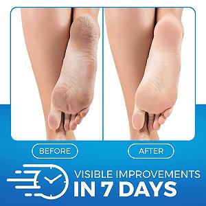 Бальзам для ніг Imperial Feet Urea зволожувальний відлущувальний із сечовиною та антиоксидантами 150 мл synthetic.ua - Фото 1