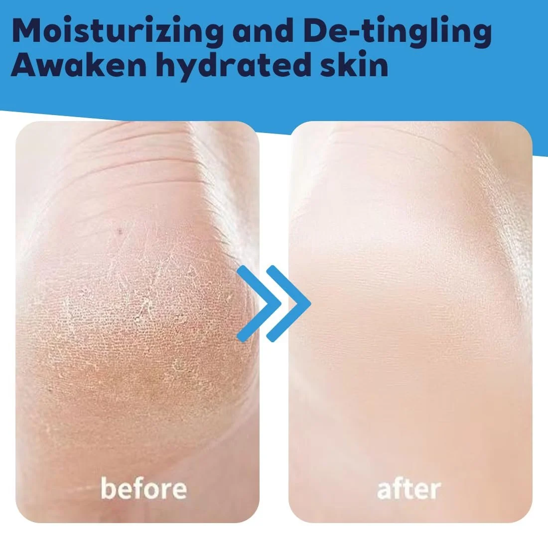 Крем-стик для ног увлажняющий против трещин с мочевиной 2 шт, фото №6