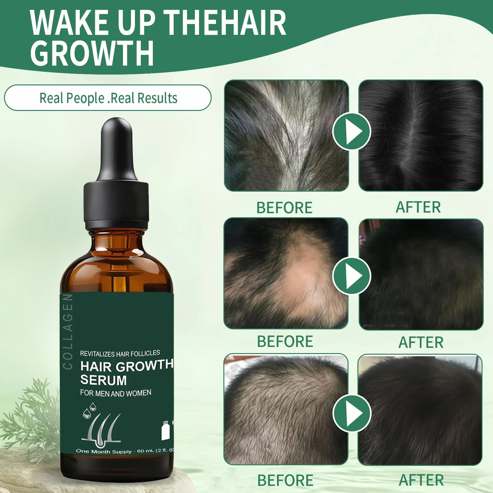 Средство для роста волос 60 мл, ускоряющее рост волос, укрепляющее волосы, сыворотка для роста волос, реактивирует уменьшенные фолликулы, фото №4 Средство для роста волос 60 мл, ускоряющее рост волос, укрепляющее волосы, сыворотка для роста волос, реактивирует уменьшенные фолликулы, фото №4