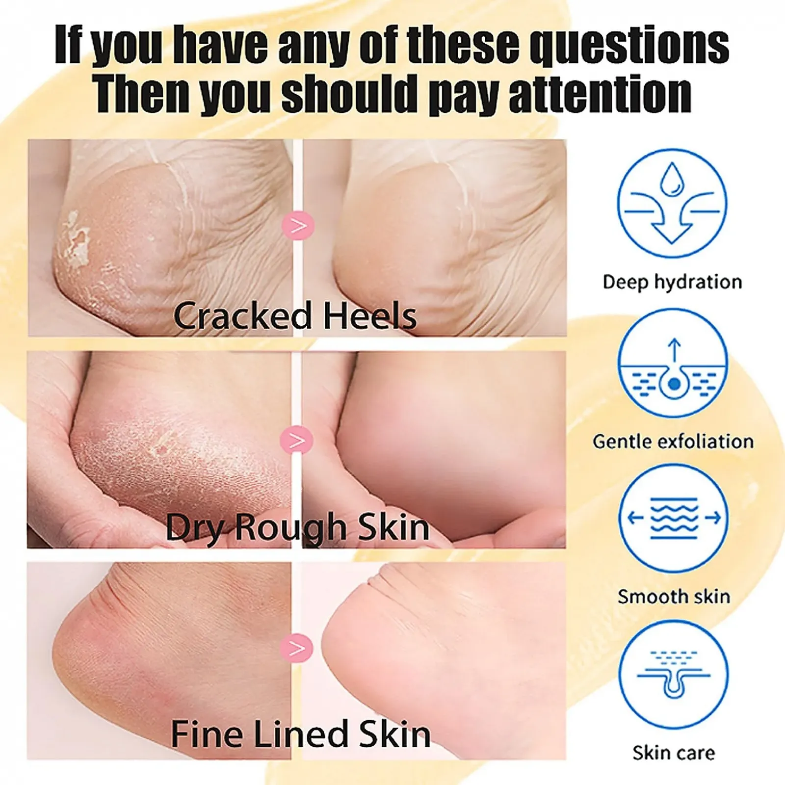 Крем для ног Callus Remover 42% Urea для потрескавшихся пяток и сухой кожи 50 г, фото №2