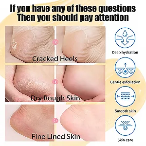 Крем для ног Callus Remover 42% Urea для потрескавшихся пяток и сухой кожи 50 г synthetic.ua - Фото 1