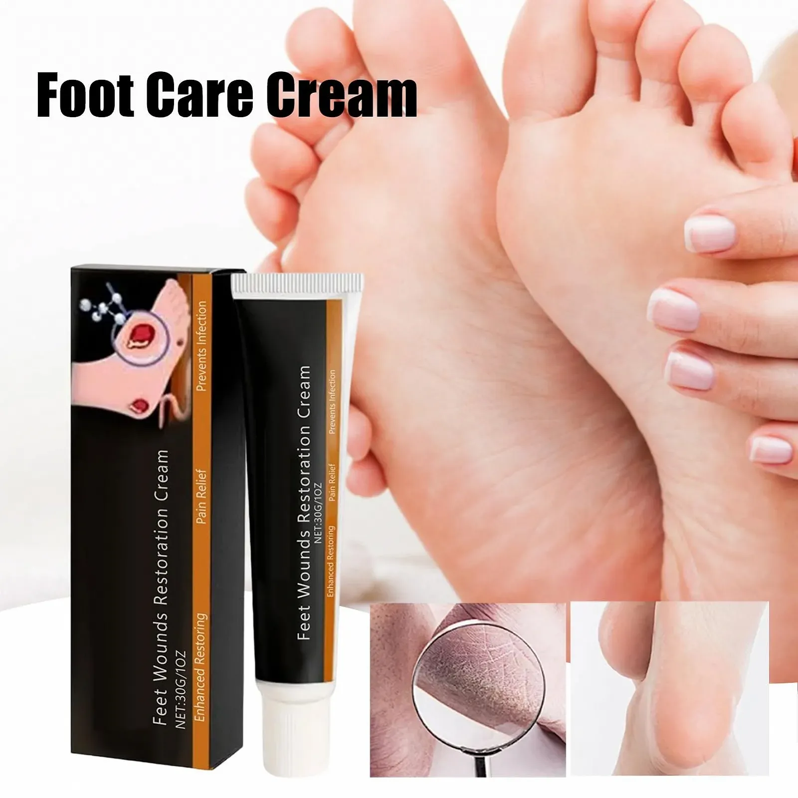 Лосьон для сухой кожи ног 30 г, фото №2