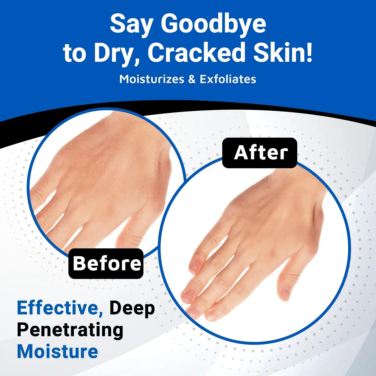 Лосьйон Dermal Therapy Alpha Hydroxy High Potency - Зволожуючий та відлущуючий засіб для сухої шкіри 10% сечовини, фото №6