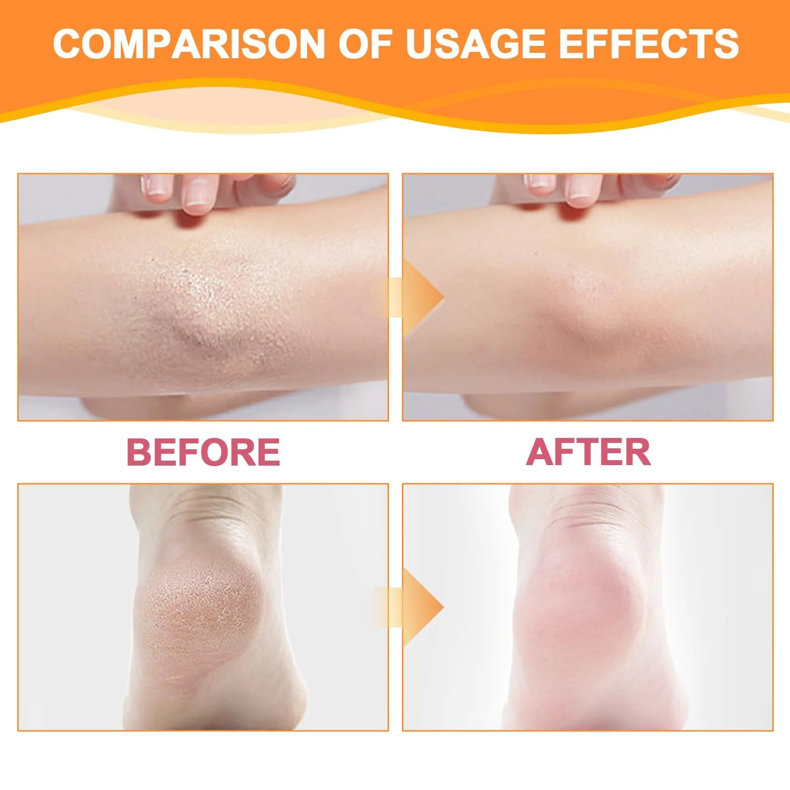 Крем для ног Hydrating and Anti-Cracking 2 шт, фото №3