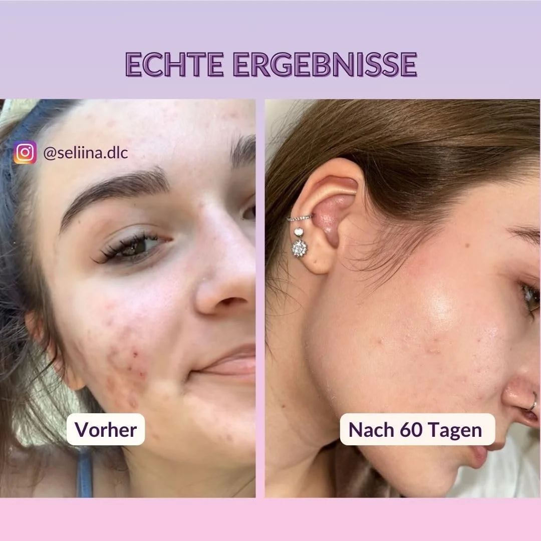 Маска для обличчя з грязi Мертвого моря Mother Nature для догляду за сухою та проблемною шкірою, 250 грам, антивікова маска, фото №4 Маска для обличчя з грязi Мертвого моря Mother Nature для догляду за сухою та проблемною шкірою, 250 грам, антивікова маска, фото №4