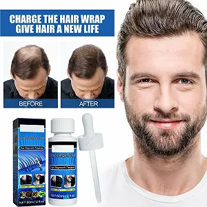 Сироватка для росту волосся Biotin Und Rizinus Haarwachstum Haarwachstum Lösung Anti Haarausfall для чоловіків та жінок synthetic.ua - Фото 1