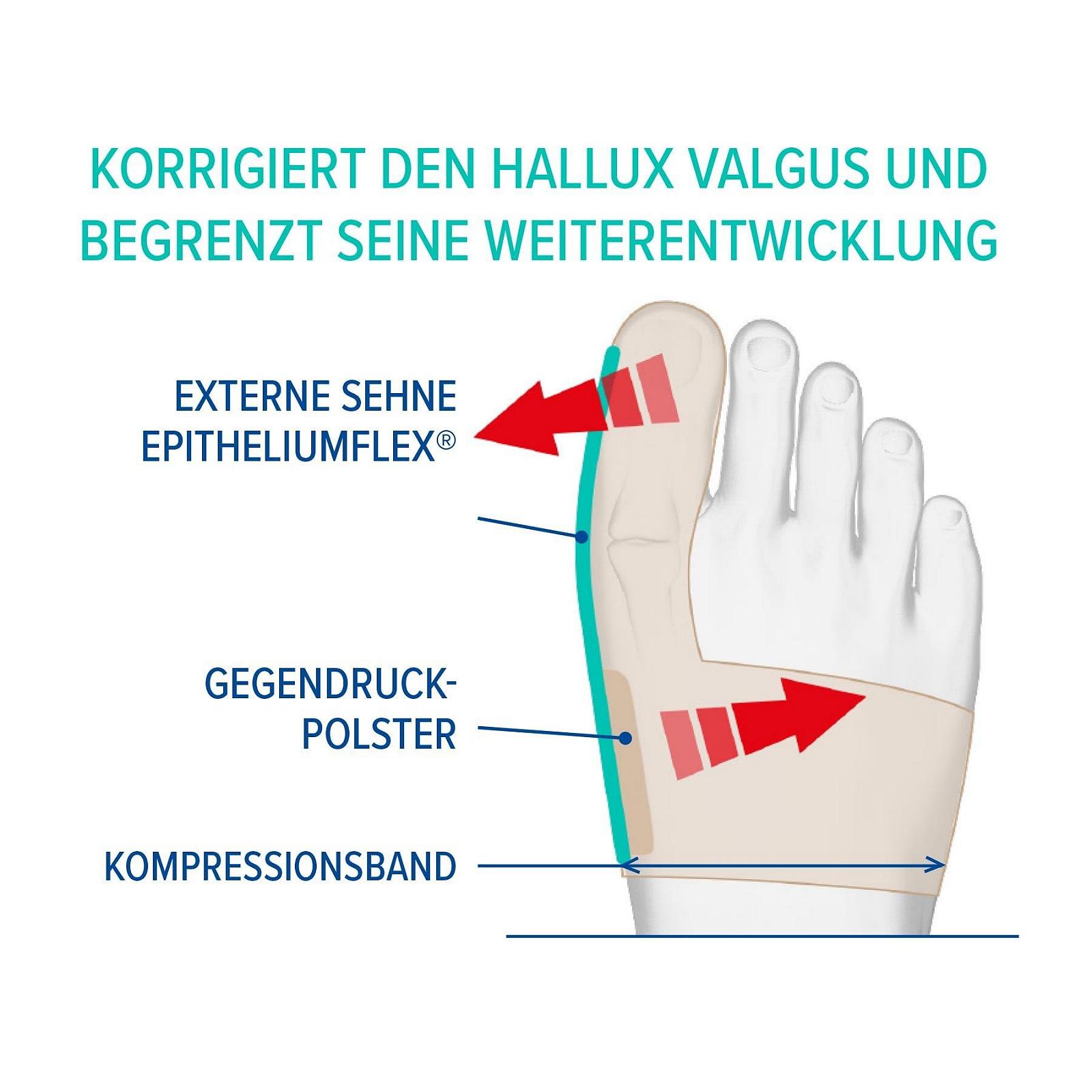 Ортез для корекції вальгусної деформації великого пальця стопи Epitact, розмір: M, фото №6