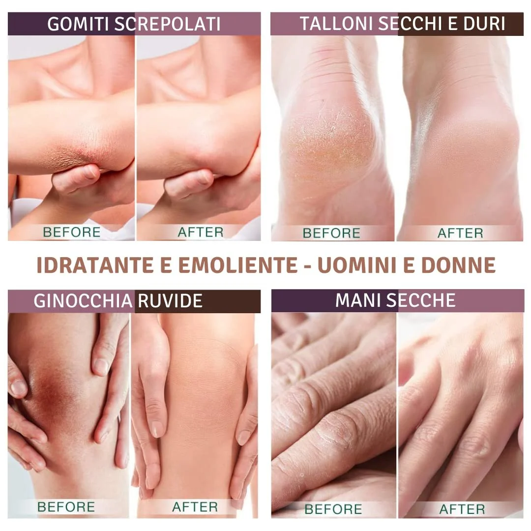 Крем для ног Urea Cream 10% 100 мл, фото №4 Крем для ног Urea Cream 10% 100 мл, фото №4