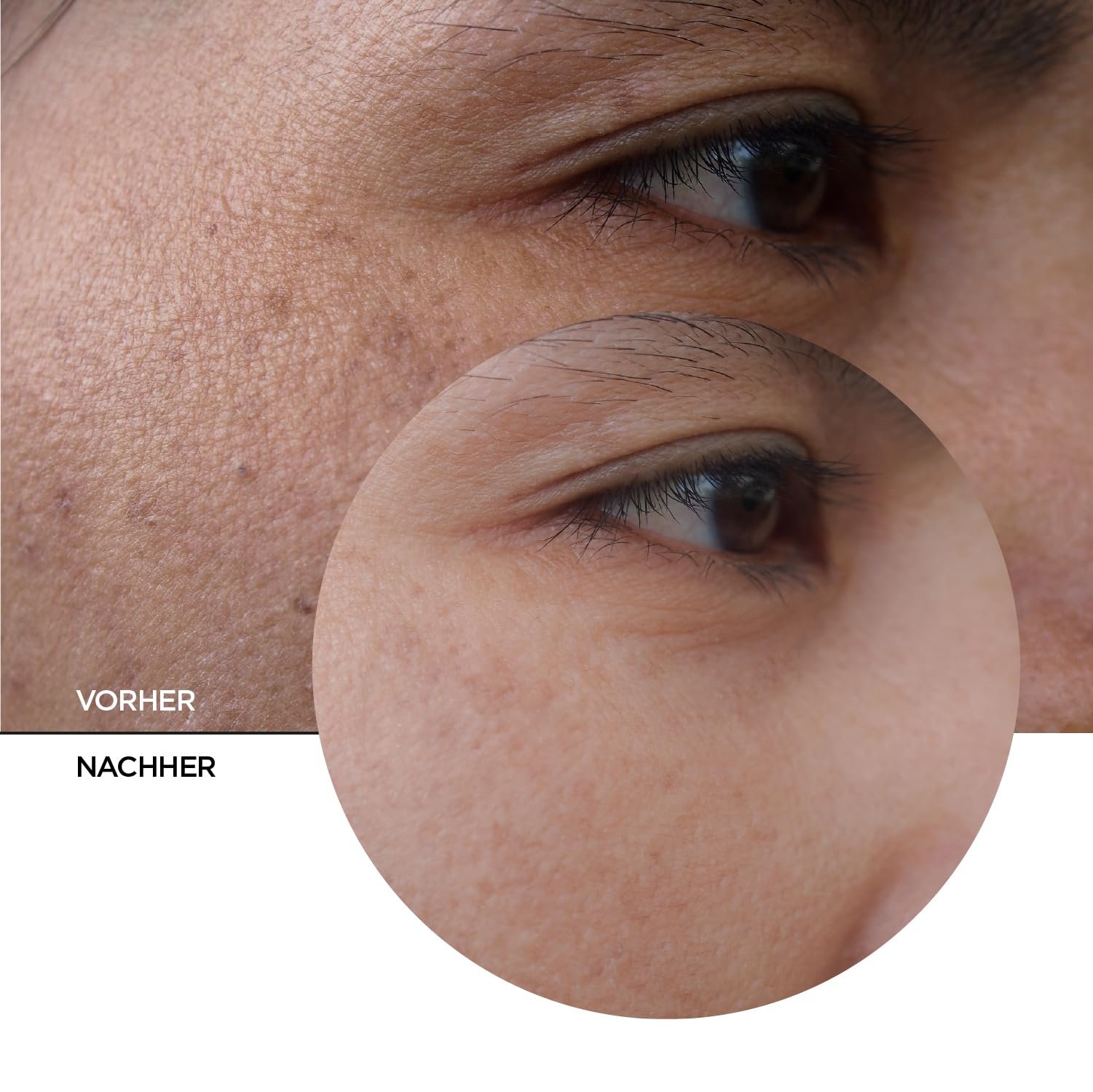 Денний крем REVOX B77 Skintreats 50 мл, фото №8 Денний крем REVOX B77 Skintreats 50 мл, фото №8