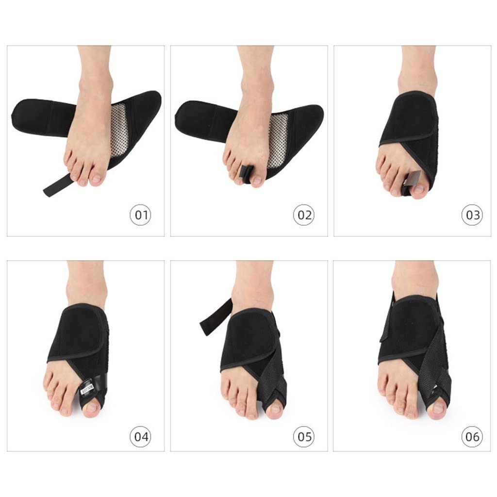 Коректор великого пальця стопи CAZARU, Hallux Splitter, денна та нічна шина, фото №2 Коректор великого пальця стопи CAZARU, Hallux Splitter, денна та нічна шина, фото №2