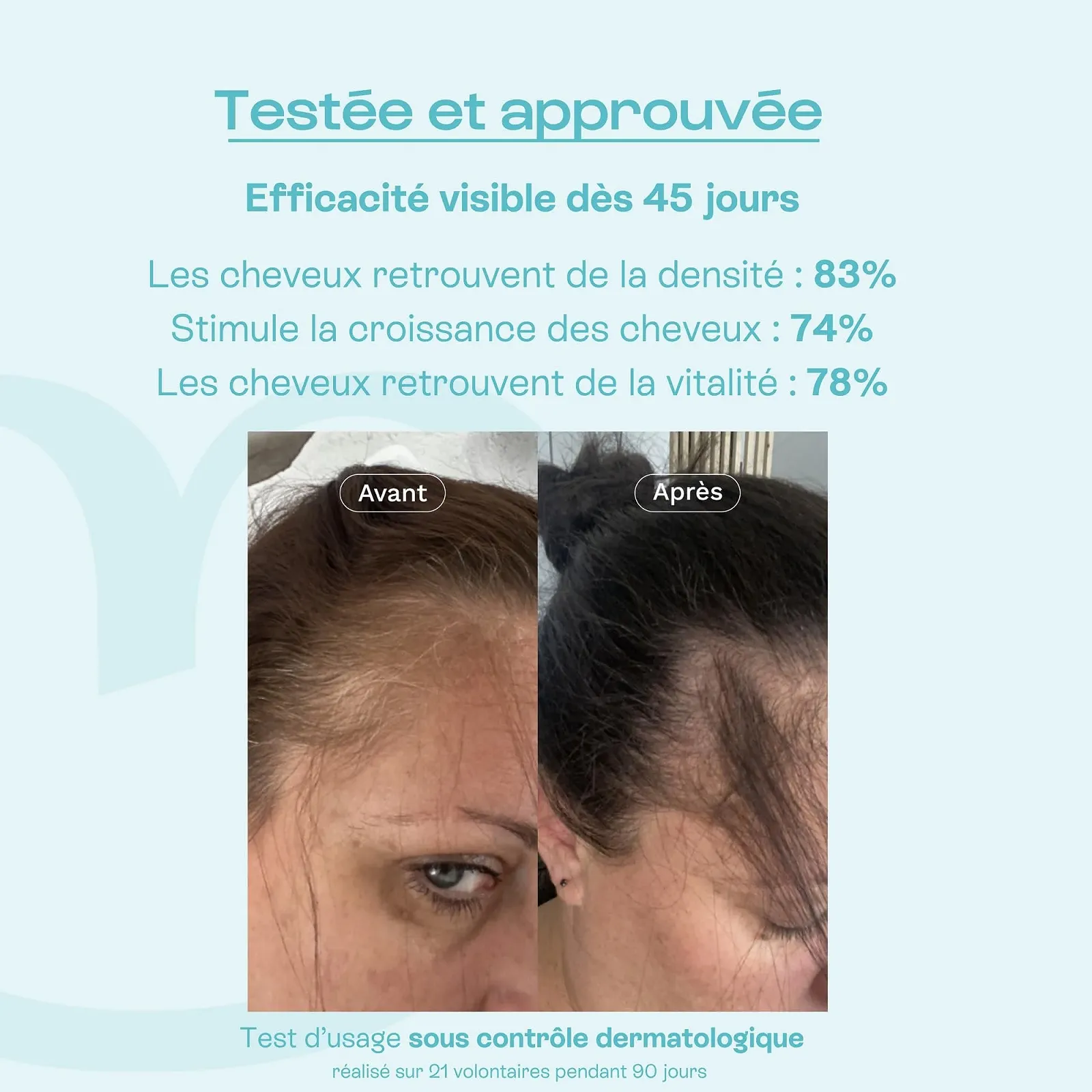 Лосьйон OMUM Mein Schub для запобігання випадіння та стимуляції росту волосся, 100 мл, зміцнюючий, фото №6 Лосьйон OMUM Mein Schub для запобігання випадіння та стимуляції росту волосся, 100 мл, зміцнюючий, фото №6