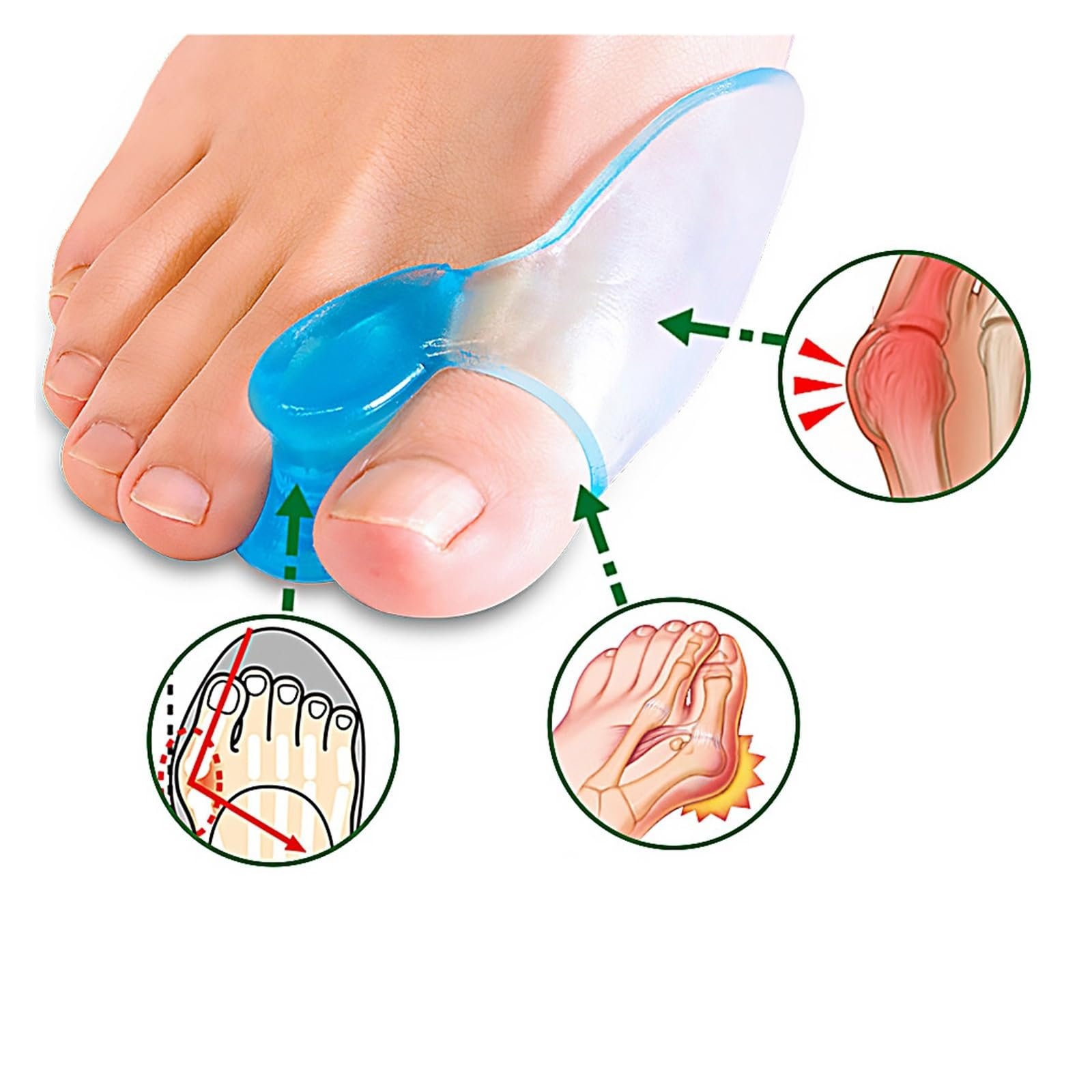 Роздільник для пальців ніг Силіконовий Захист для пальців ніг Ортопедичний для вальгусної деформації, фото №7