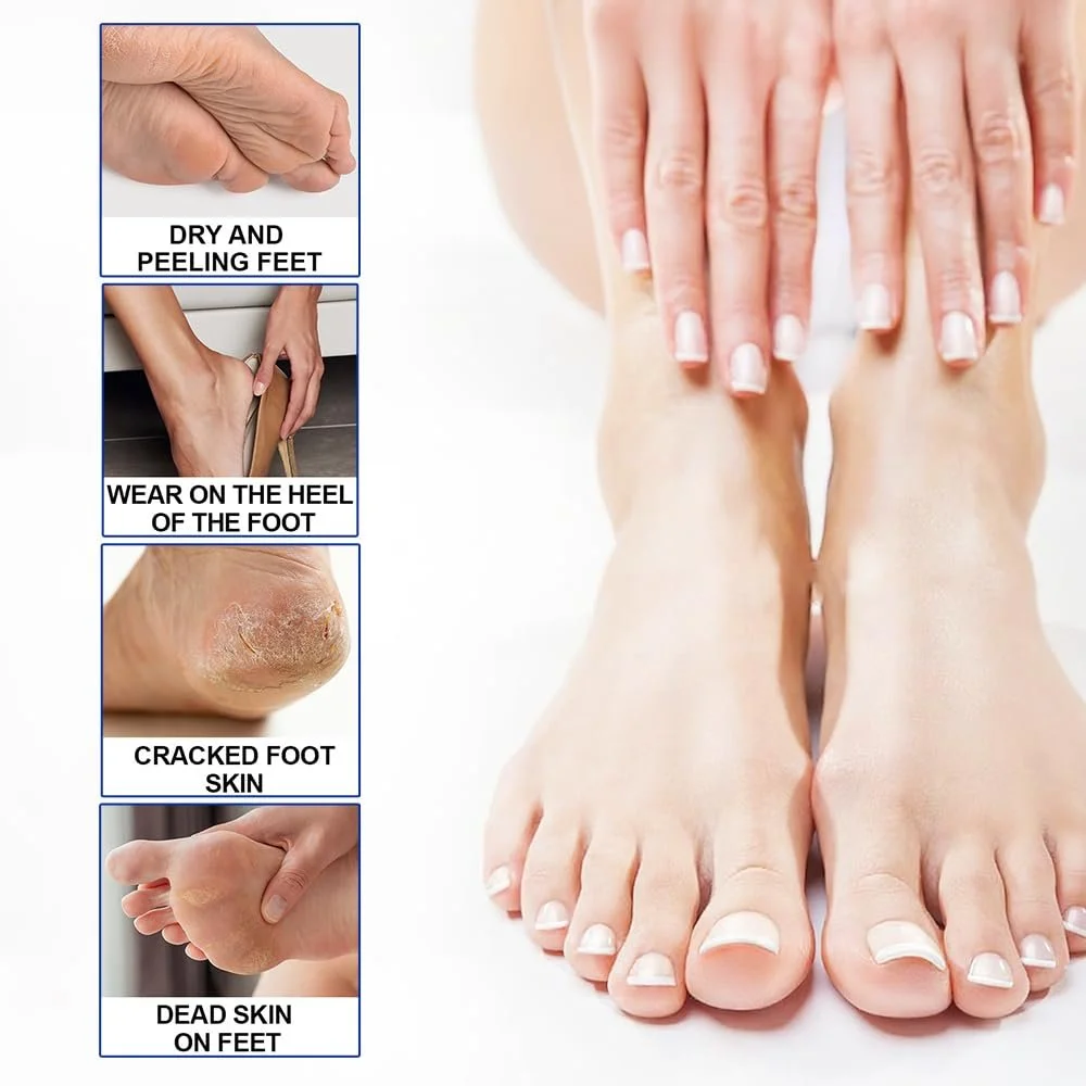 Крем-стик для ног Fengyang Urea для локтей, коленей, стоп и рук, фото №5