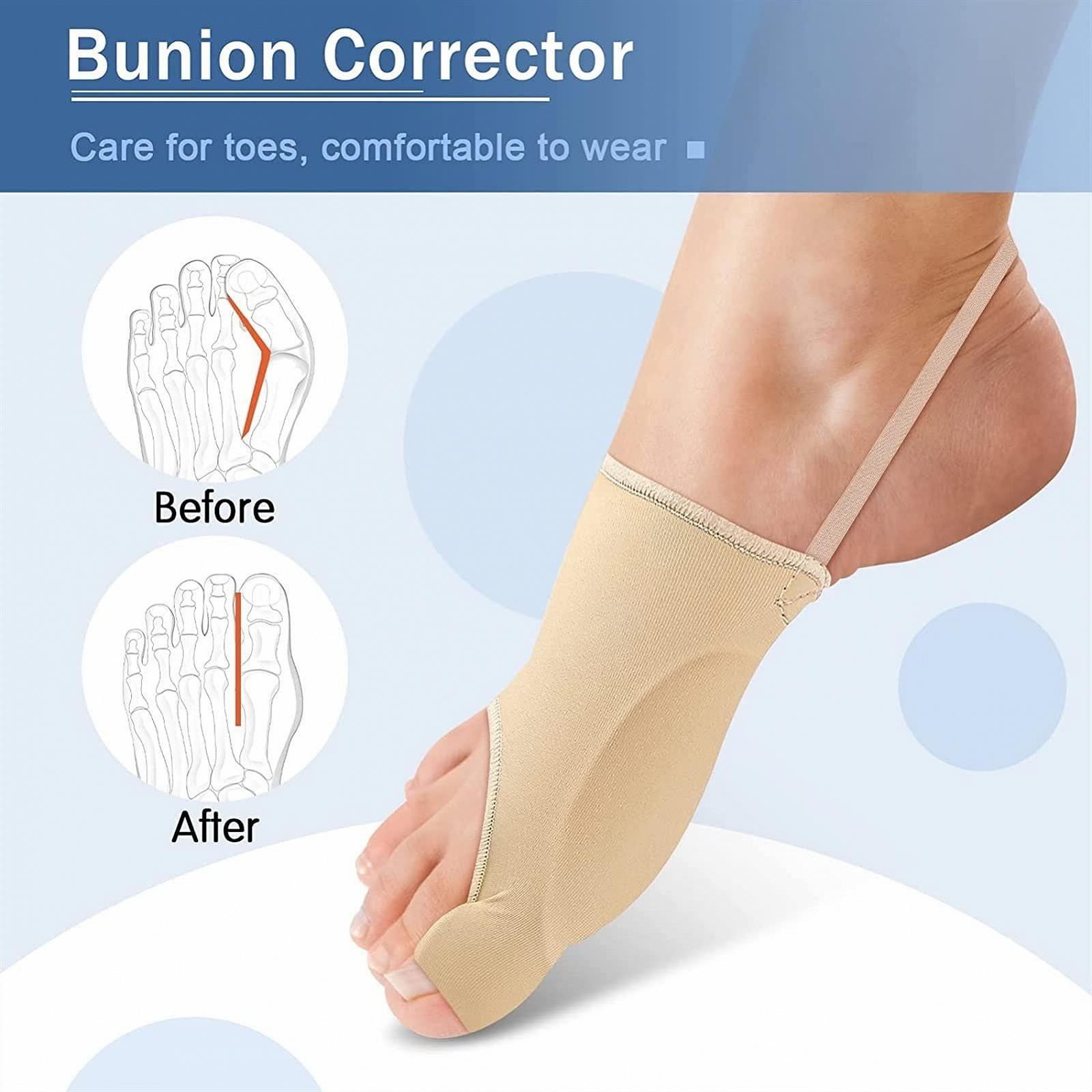 Роздільник для пальців ніг при перекриванні, ортопедична шина для великого пальця стопи, фото №7 Роздільник для пальців ніг при перекриванні, ортопедична шина для великого пальця стопи, фото №7