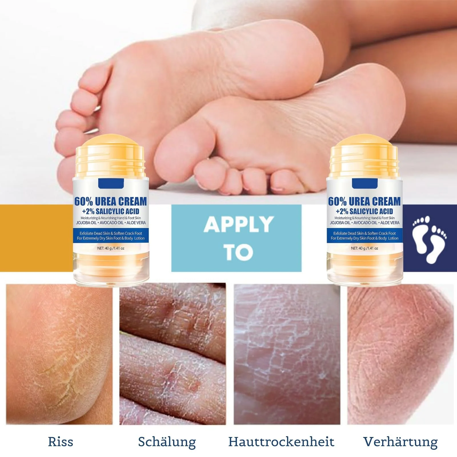 Крем для ног Urea Cream 60% против трещин и мозолей упаковка из 2 шт., фото №4 Крем для ног Urea Cream 60% против трещин и мозолей упаковка из 2 шт., фото №4