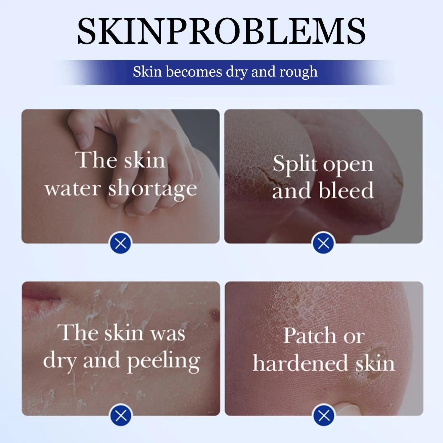 Крем-стик для ног Avocado увлажняющий против трещин для сухой кожи и пяток 40 г, фото №6